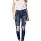 Judy Blue - BUTTON FLY SKINNY JEANS