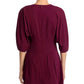 Steve Madden - Dayton V-neck Mini Dress