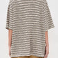 Free People - All Love Stripe Oversized Pocket Tee