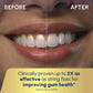 Waterpik Evolution Water Flosser - Imperfect Box