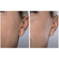 Spa Sciences SIMA Deluxe Sonic Dermaplaning Tool for Exfoliation & Peach Fuzz Removal - Imperfect Box