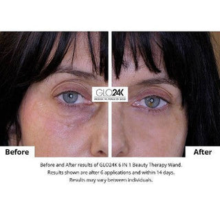 GLO24K 6-in-1 Beauty Therapy Wand for Face Eyes and Neck - New