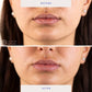 BioRepublic SkinCare Lip Masks 6pk - New