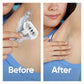 Venus Deluxe Smooth Sensitive Women's Razor + 2 Razor Blade Refills - Imperfect Box
