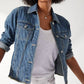 Tommy Bahama - Zesty Zebra Denim Jacket