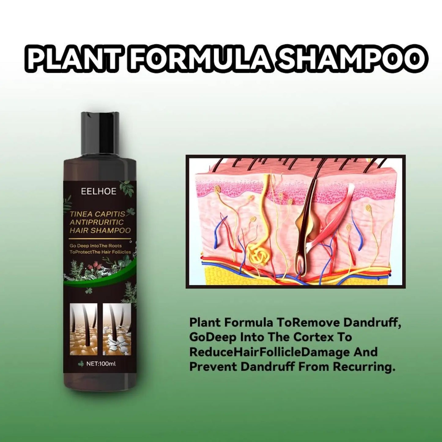 Anti-dandruff Shampoo for Itch Relief and Oil Control