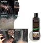 Anti-dandruff Shampoo for Itch Relief and Oil Control