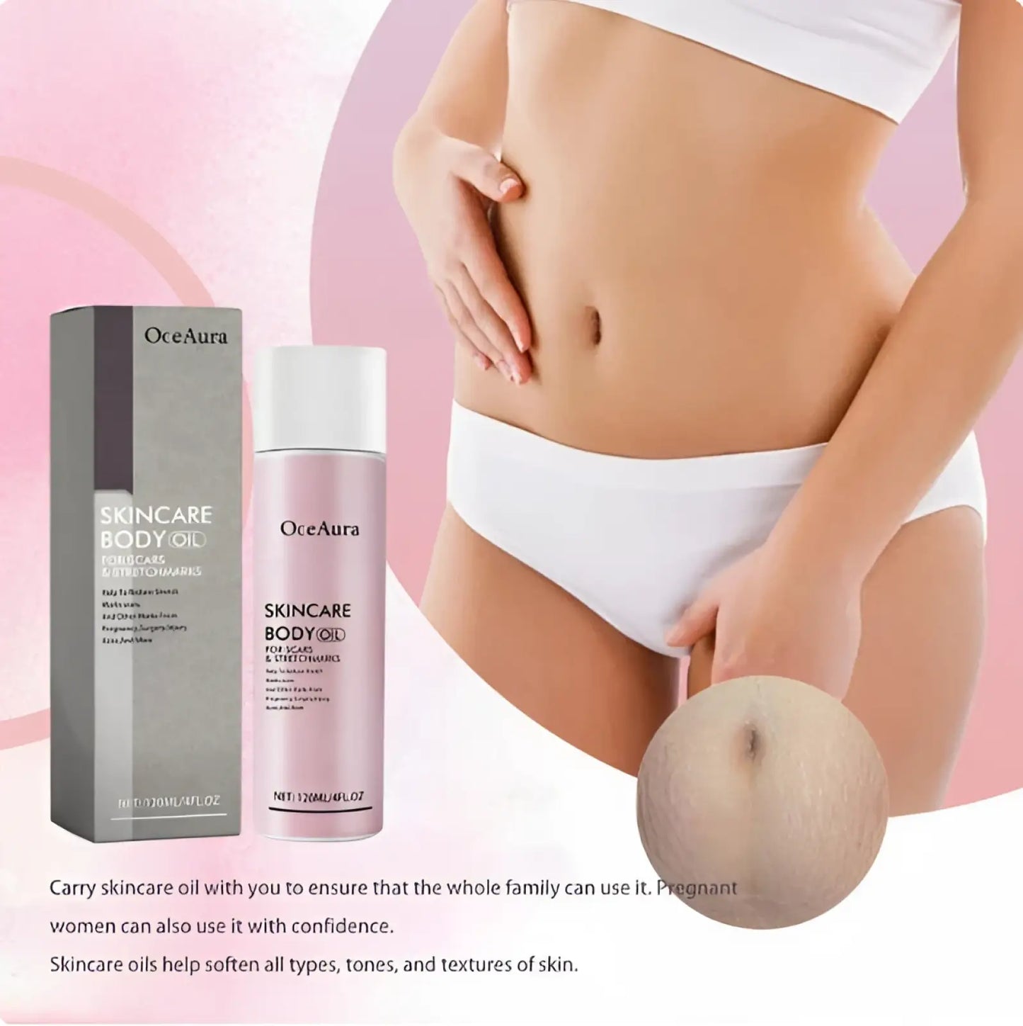 Body Oil for Scars and Stretch Marks 2oz Bottle