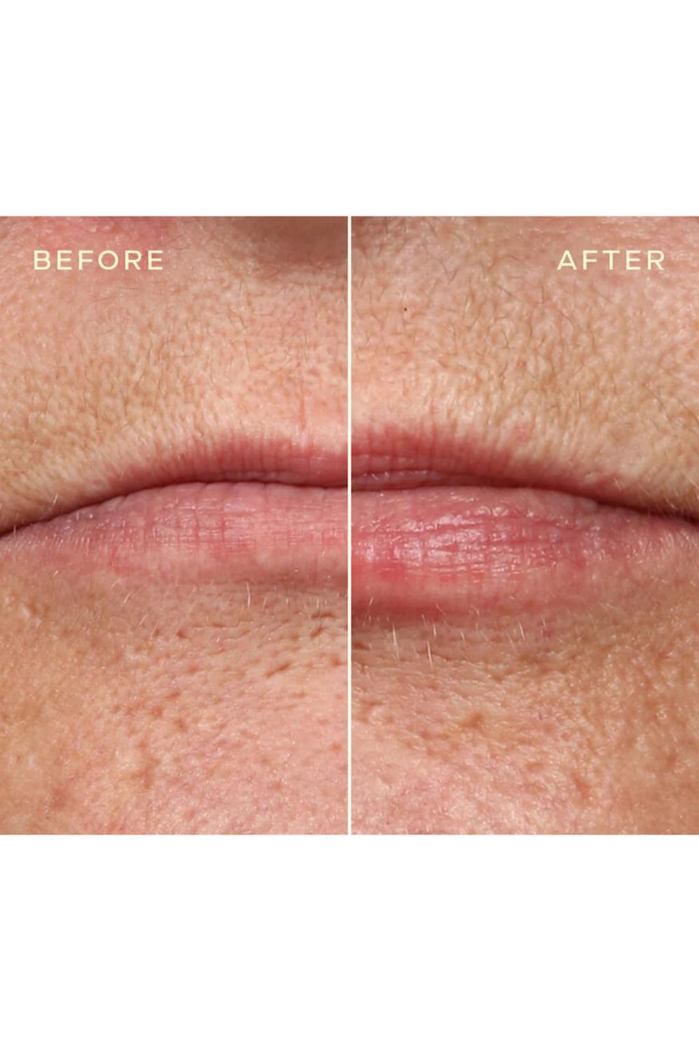 Ourself - Lip Filler Refill