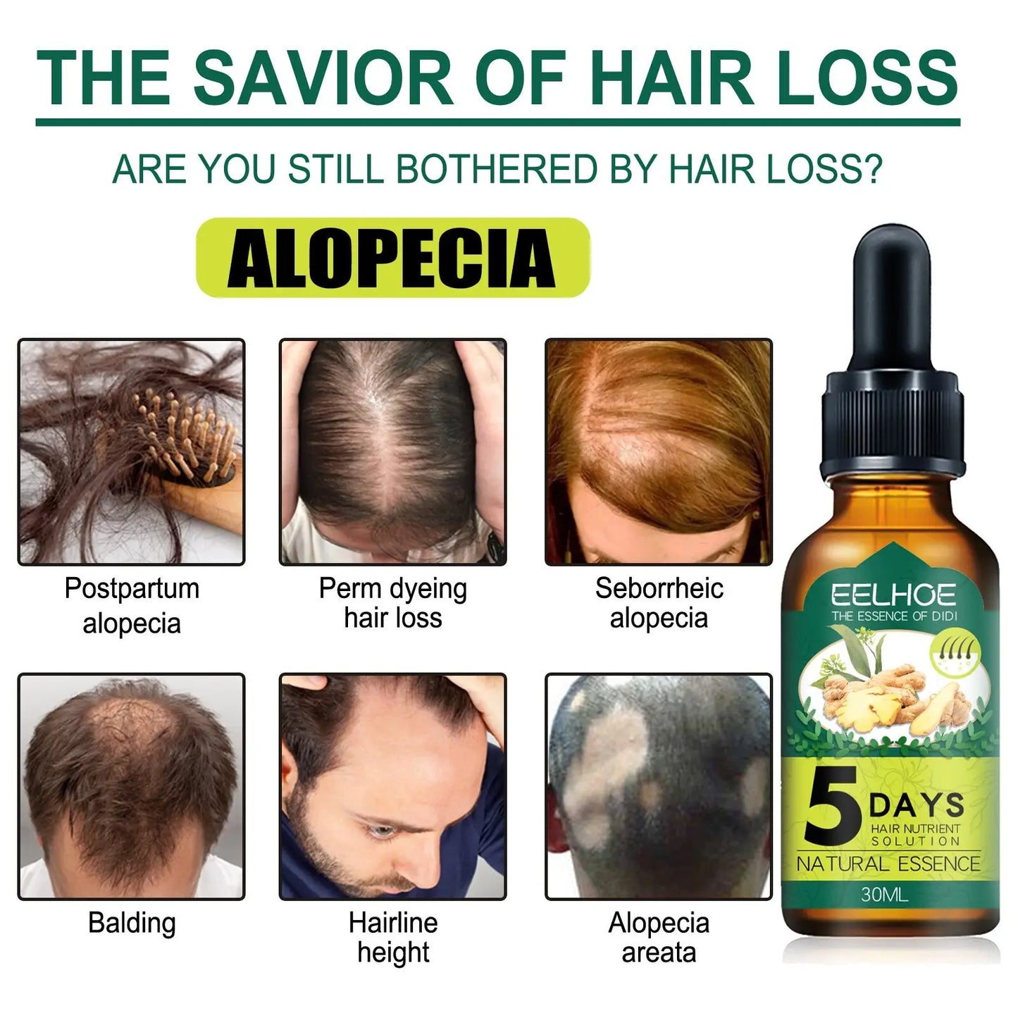 Ginger Hair Essential Oil 5 Days Nutrient Solution