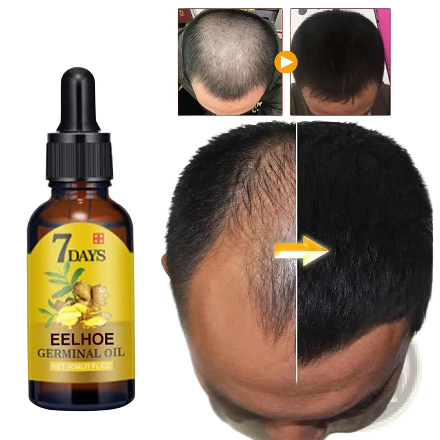 Ginger Hair Growth Oil 7 Days Anti Hair Loss Serum