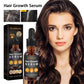 Hair Growth Serum Anti Hair Fall Oil 30ml