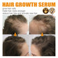 Hair Growth Serum Anti Hair Fall Oil 30ml