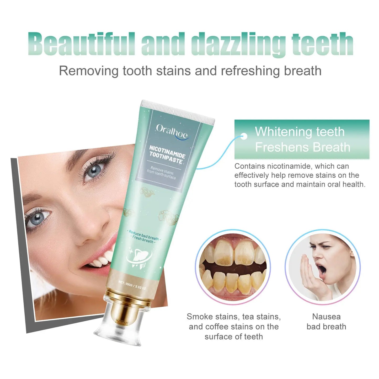 Nicotinamide Teeth Whitening Toothpaste Stain Removal 100g
