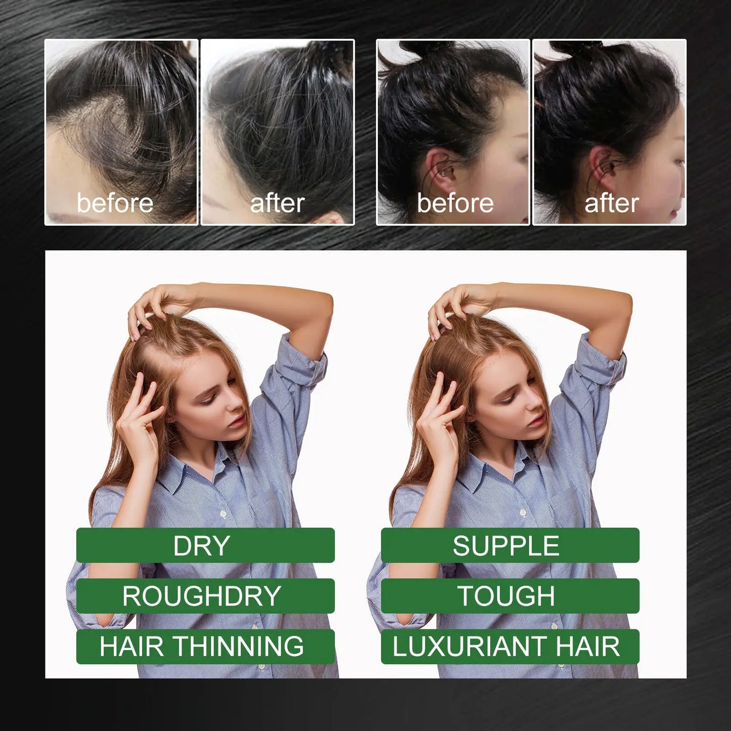 Rosemary Essential Oil for Hair Growth 60ml Ouhoe