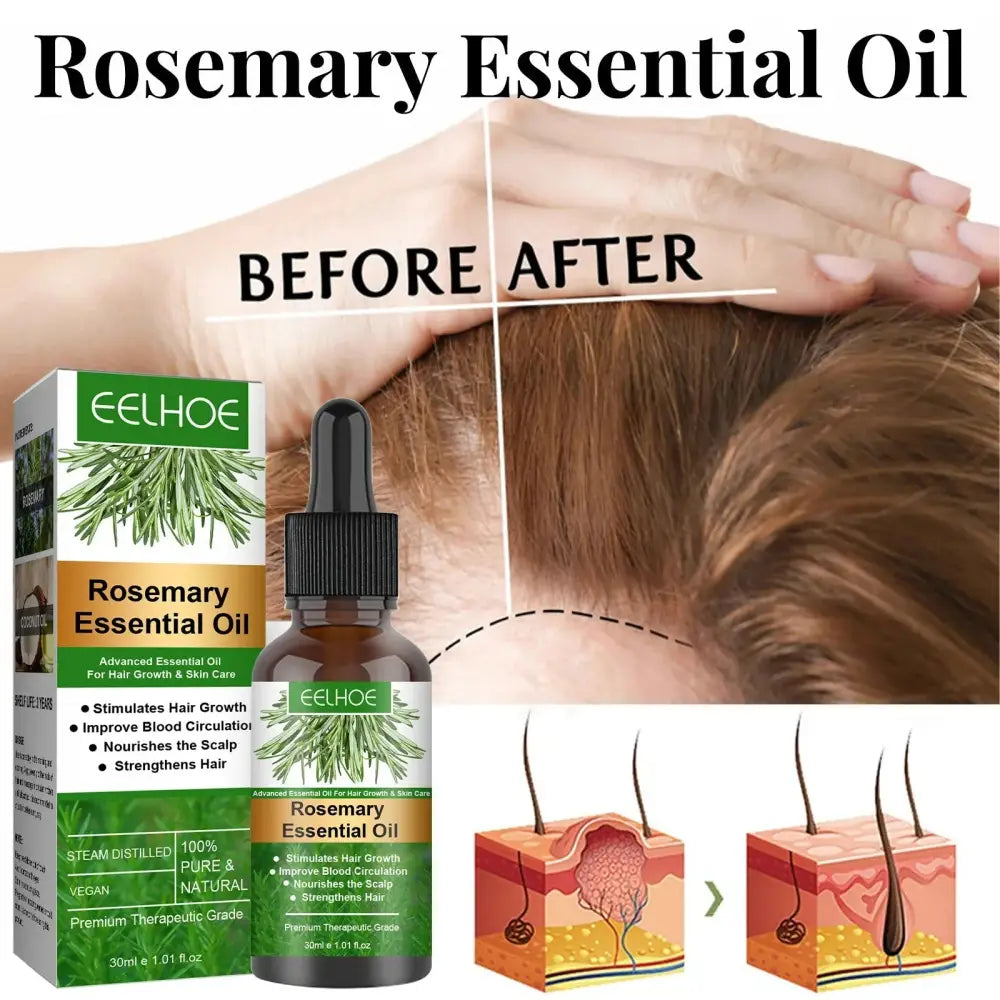 Eelhoe Rosemary Essential Oil for Hair Growth and Scalp Care